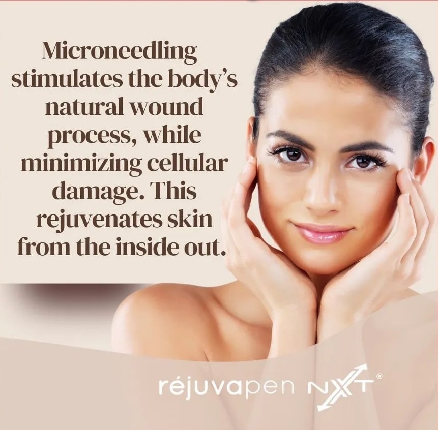 Microneedling W/Hyaluronic Acid Drew & Co Medical