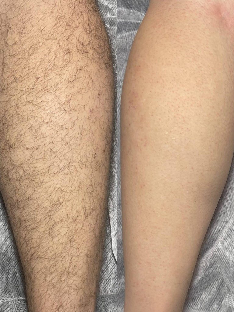 waxing in Kenosha, full-body waxing in Kenosha, med spa in Kenosha