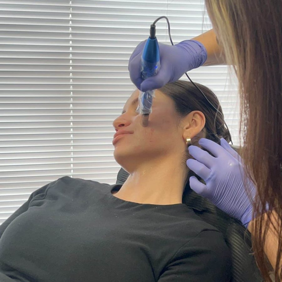 microneedling in kenosha, medical aesthetics in kenosha, kenosha microneedling