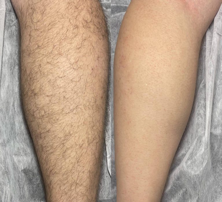 Waxing Services in Kenosha waxing services in kenosha, waxing in kenosha, full body wax in kenosha