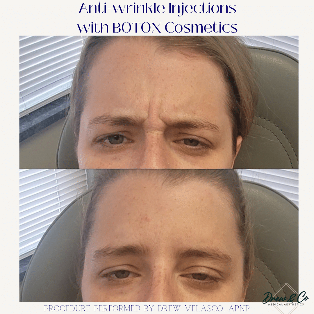 Beige Brown Neutral Before + After Instagram Post_20240816_084732_0000