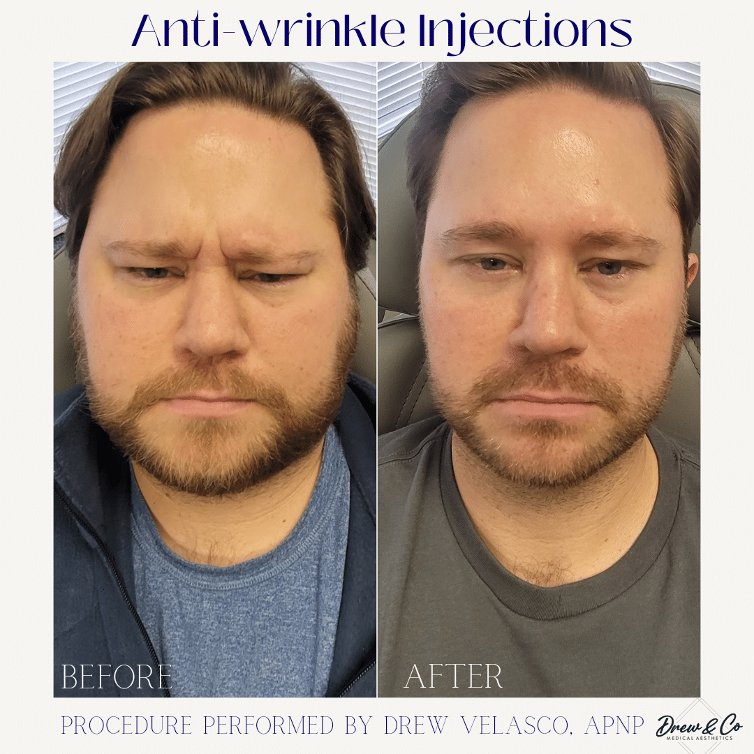 Beige Brown Neutral Before + After Instagram Post_20241006_143621_0000