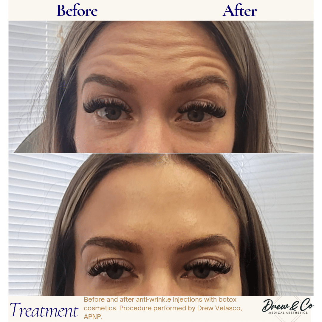 Neutral Before and After Instagram Post_20240921_093307_0000