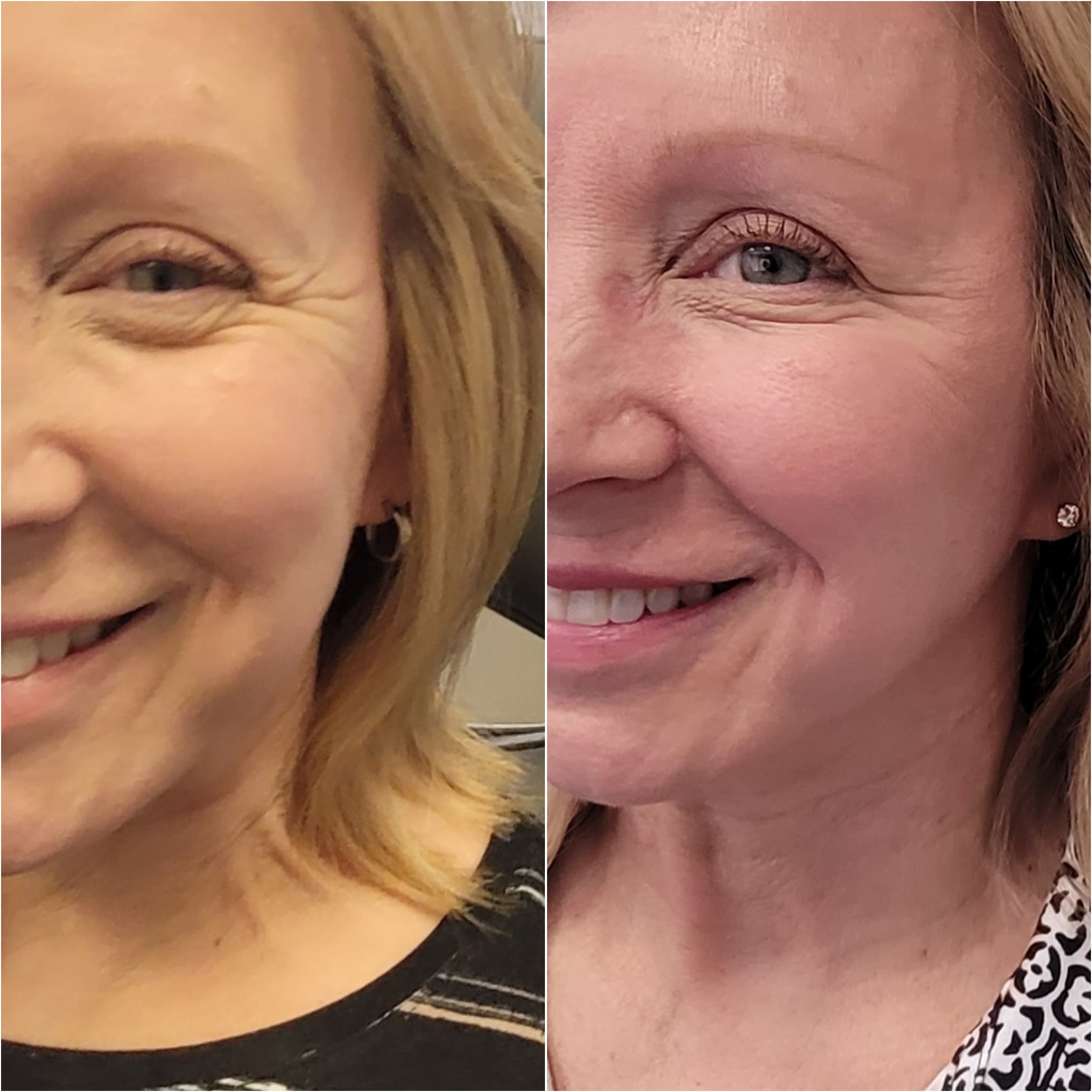 PhotoCollage_1721408930376