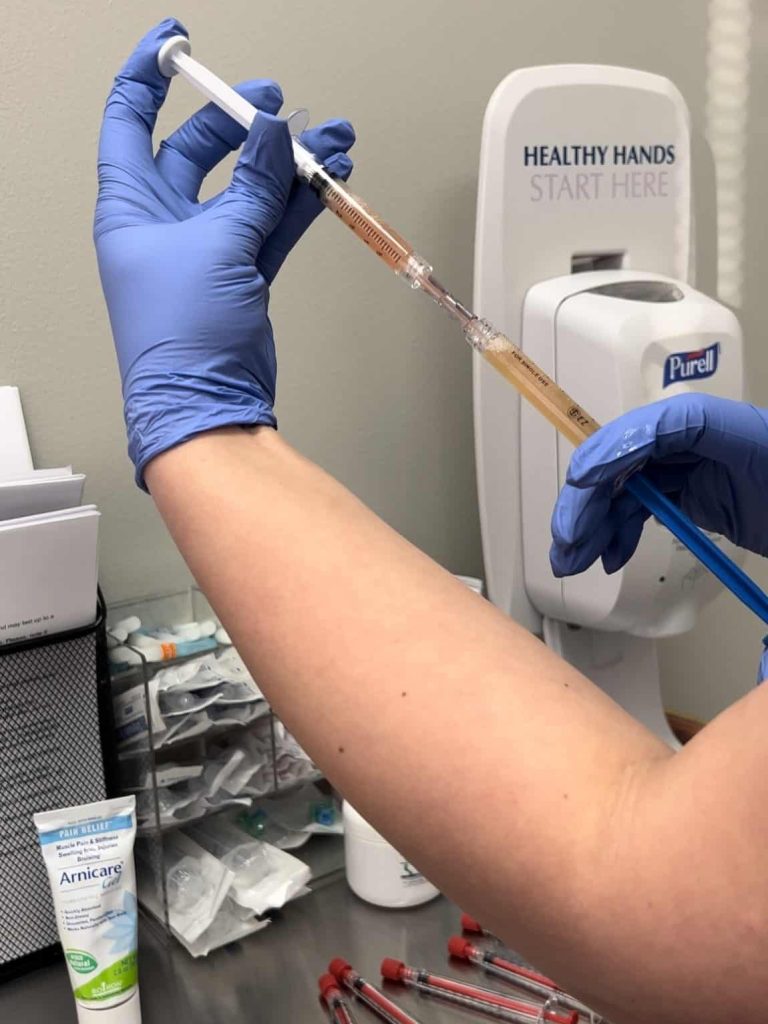 facial filler in Kenosha, facial filler Kenosha, facial filler near Kenosha