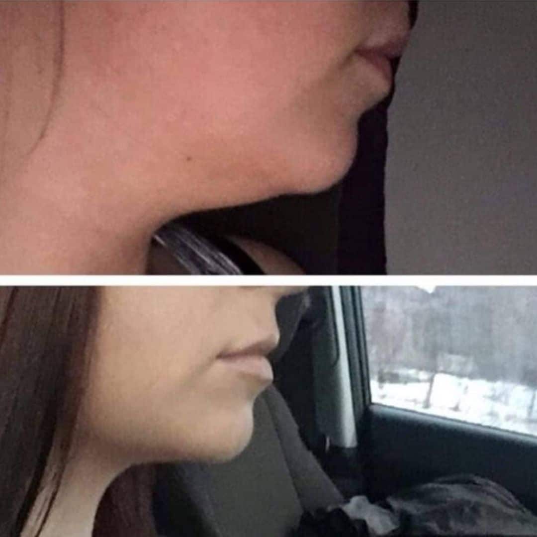 Best Medical Weight Loss in Kenosha, Best Medical Weight Loss in Kenosha for face, Best Medical Weight Loss in Kenosha for stomach, Best Medical Weight Loss in Kenosha for abs, is drew and co the Best Medical Weight Loss in Kenosha