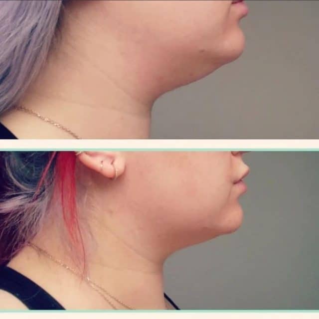 medical weight loss clinic in Kenosha, WI medical weight loss clinic in Kenosha, weight loss program Kenosha, Drew & Co. Medical Aesthetics