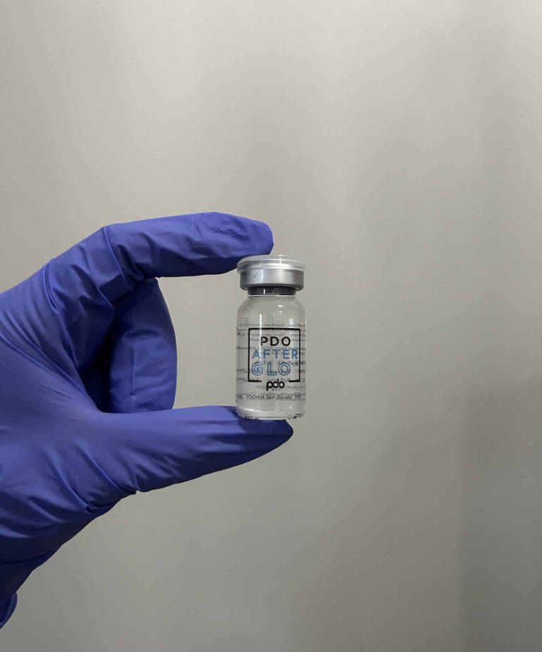 dark spot correction in Kenosha, skin brightening Kenosha, hyperpigmentation treatment Kenosha