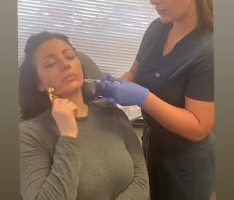 Sculptra in Kenosha, collagen stimulating treatment Kenosha, facial rejuvenation medspa Kenosha WI