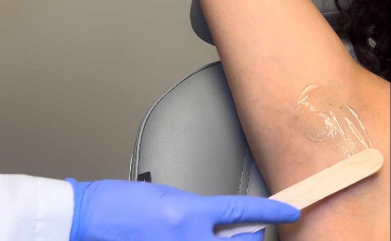 laser hair removal in Kenosha, unwanted hair reduction, smooth skin Kenosha